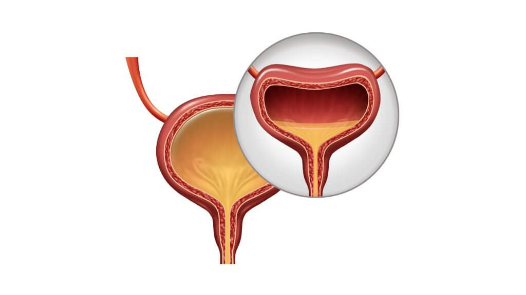 膀胱のイメージ図